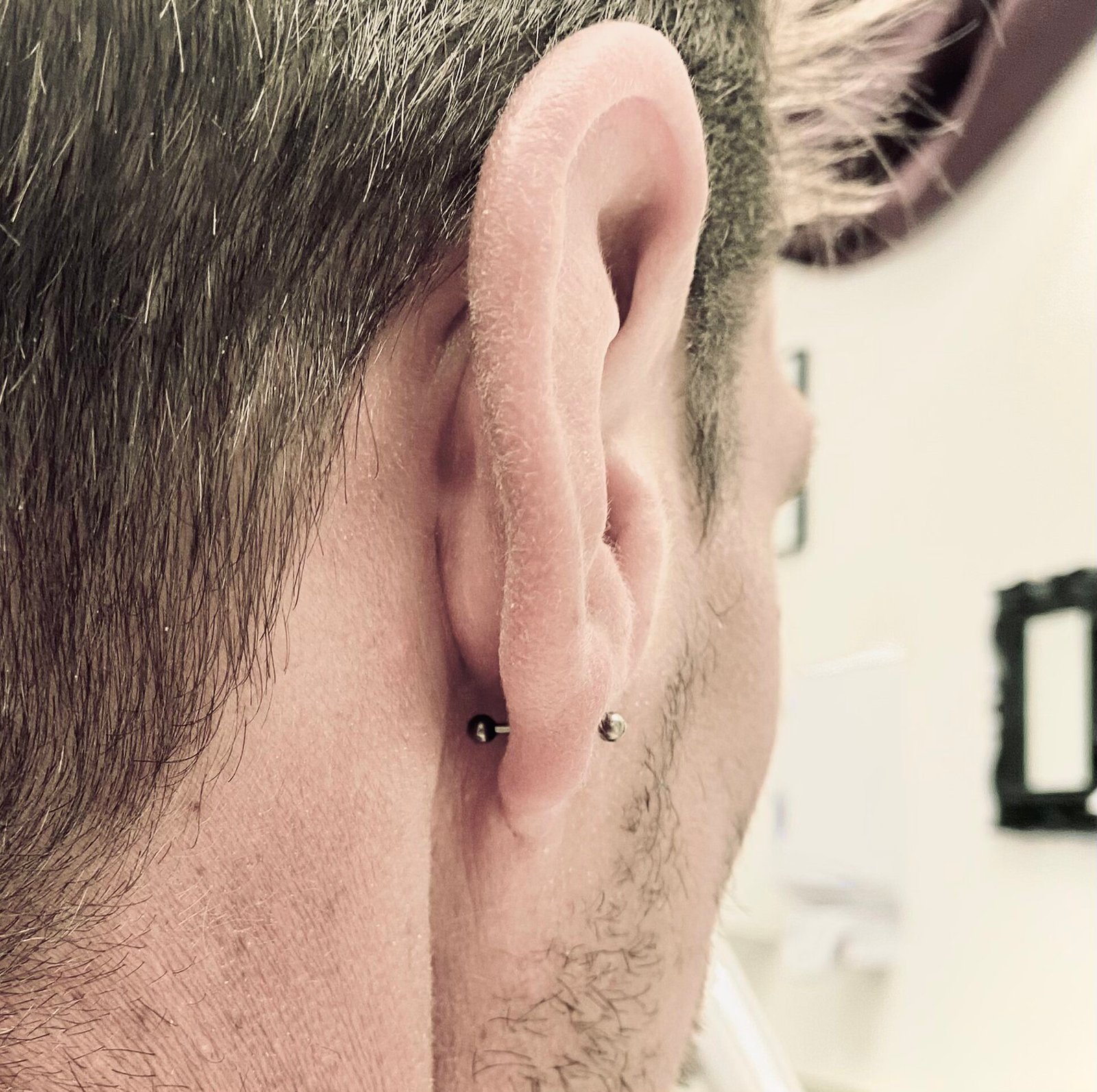 Lobe